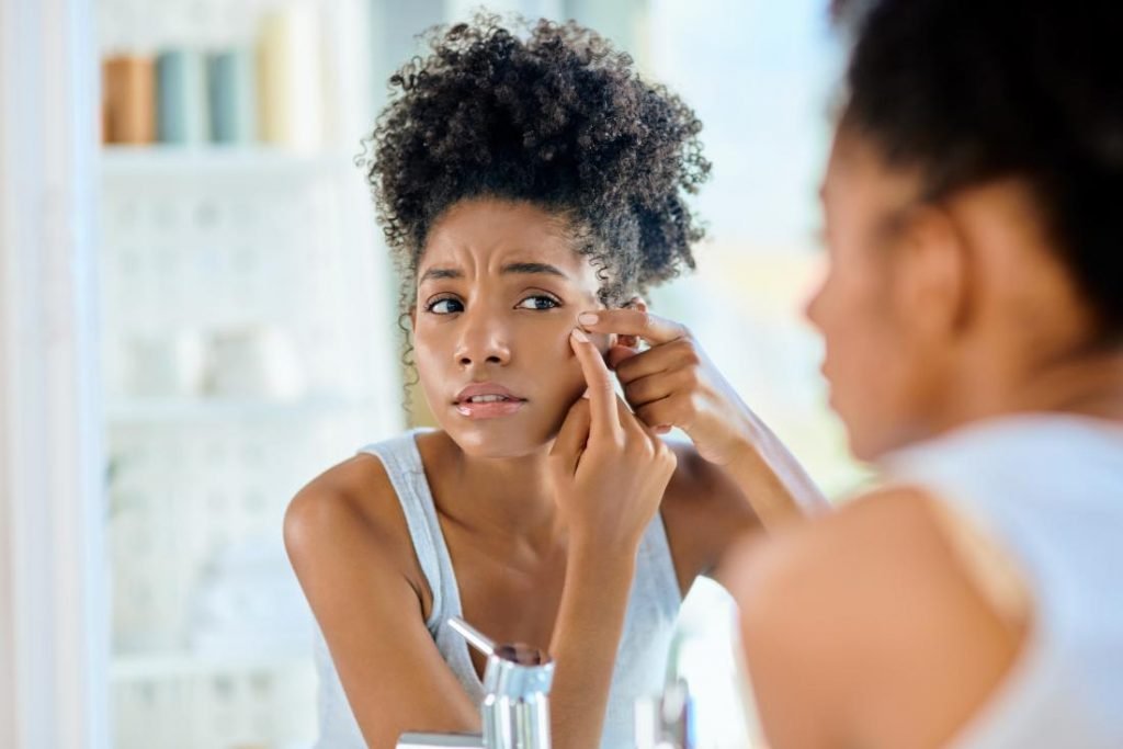 How to Treat PCOS Acne? We've Got Tips on How to Treat & Manage It!